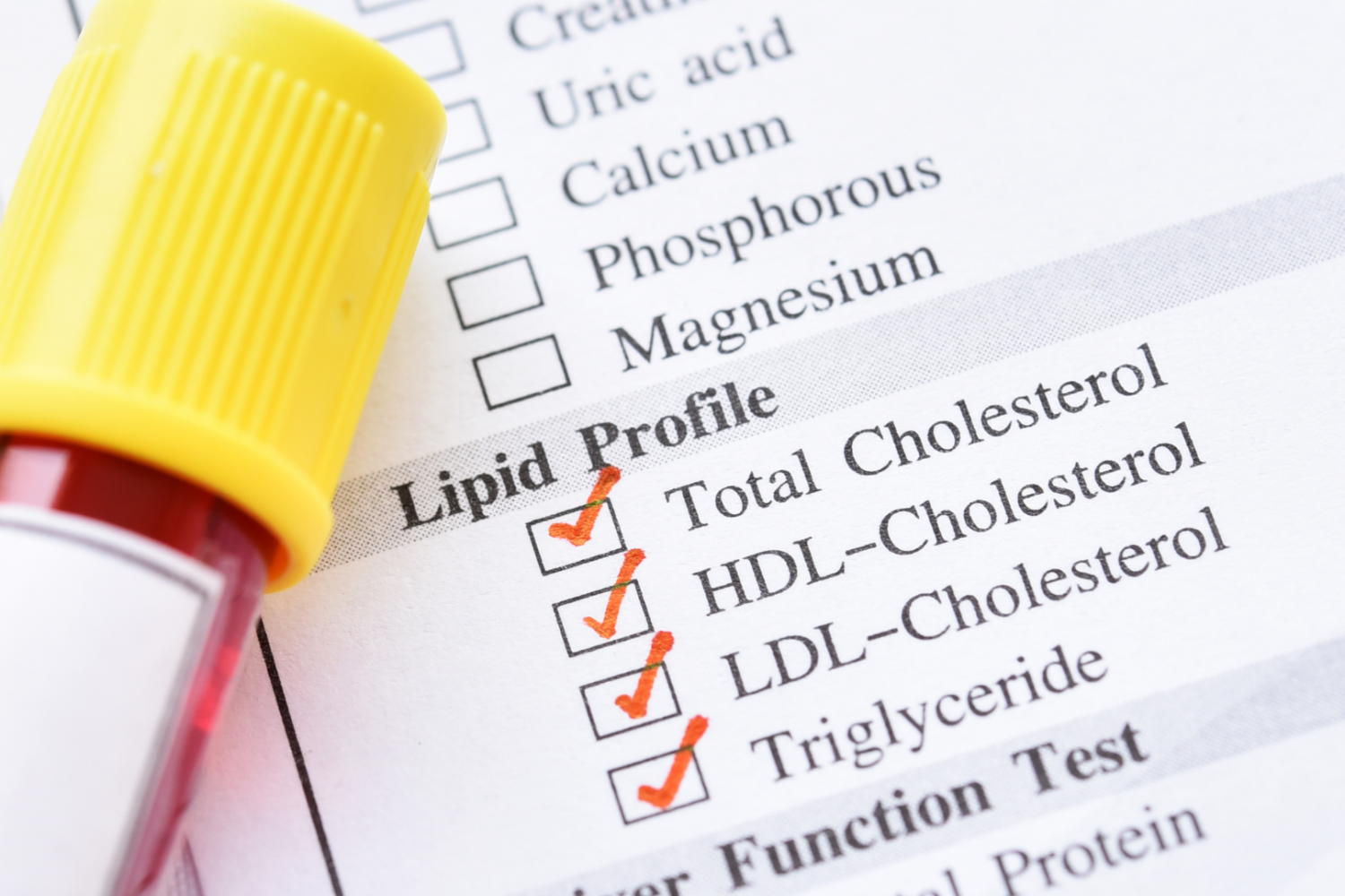 Wynik badania lipidogramu z zaznaczonymi wartościami całkowitego cholesterolu, HDL, LDL i trójglicerydów oraz probówka z krwią, ilustracja kontroli poziomu lipidów we krwi i oceny ryzyka sercowo‑naczyniowego.