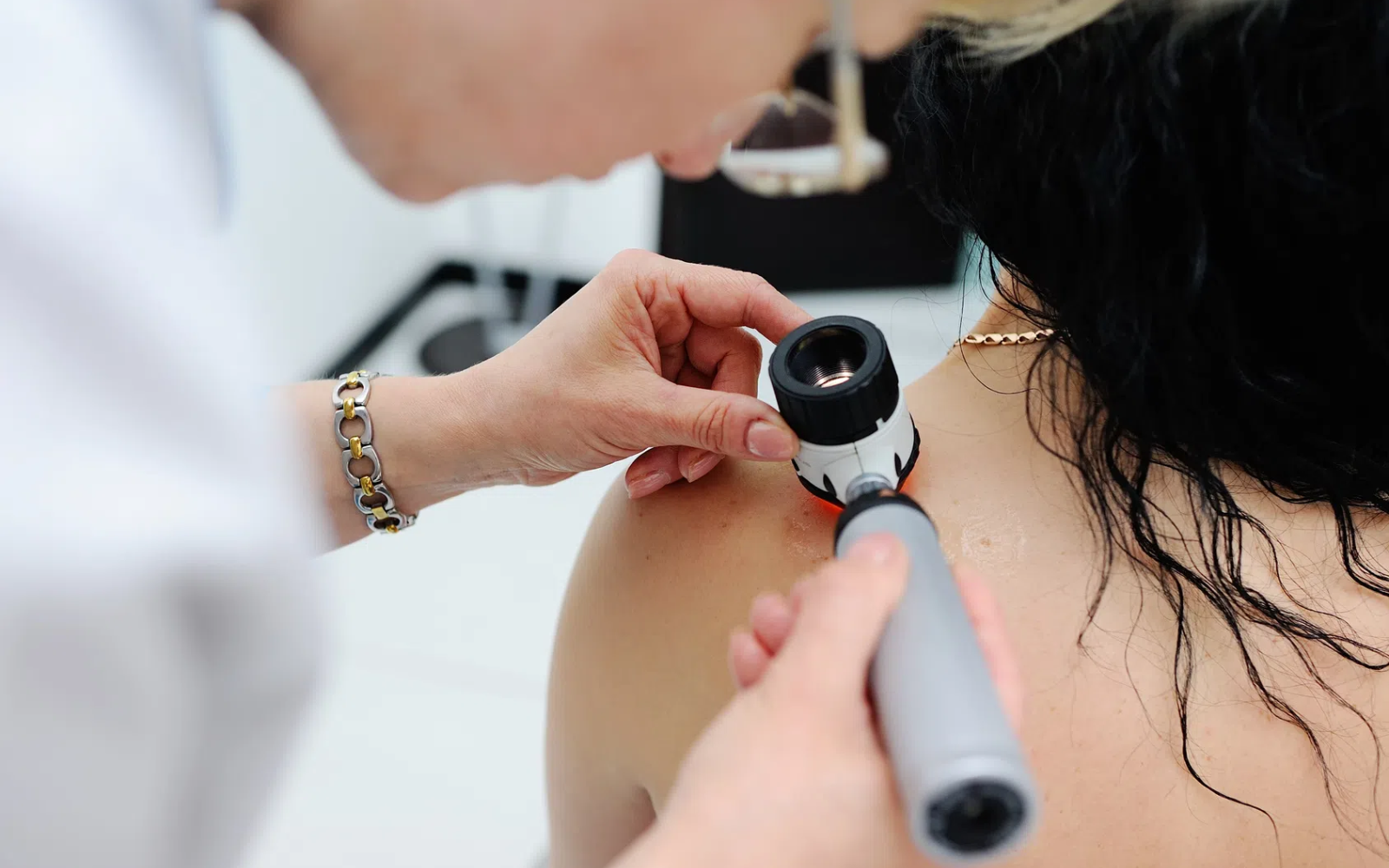 Dermatoskopia wykonywana w gabinecie dermatologicznym z użyciem dermatoskopu przyłożonego do znamienia na skórze pleców, obraz przedstawiający badanie zmian skórnych w kierunku czerniaka oraz ocenę pieprzyków i innych znamion barwnikowych.