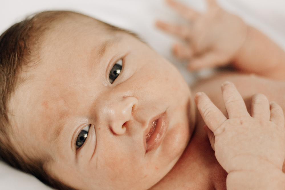 Niemowlę leżące na jasnym podłożu, z widoczną skórą torsu i dłońmi uniesionymi do góry