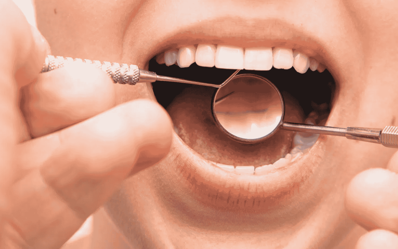 Badanie jamy ustnej wykonywane przez stomatologa z użyciem lusterka dentystycznego i zgłębnika, obraz przedstawiający diagnostykę aft w jamie ustnej, zmian błony śluzowej oraz ocenę stanu zdrowia zębów i dziąseł.