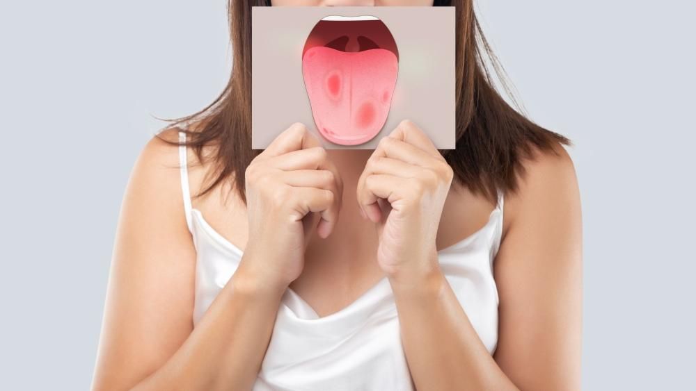 Kobieta trzymająca przed twarzą kartkę z ilustracją jamy ustnej, a dokładniej języka z widocznymi zmianami chorobowymi