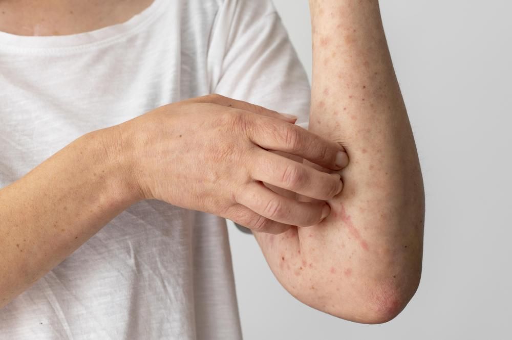 alergia skórna na przedramienu