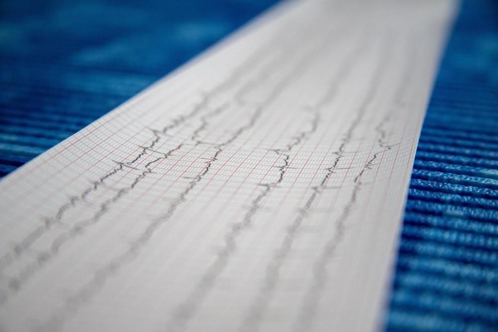 wyniki z badania EKG serca