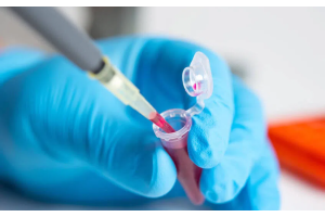 Zbliżenie na probówkę z krwią trzymaną w rękawiczce laboratoryjnej, do której wprowadzana jest pipeta z próbką, obraz przedstawiający pobranie i przygotowanie krwi do badań laboratoryjnych, np. analizy poziomu glukozy.