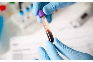 Probówka z pobraną próbką krwi trzymana w dłoniach w rękawiczkach laboratoryjnych, obraz przedstawiający badania diagnostyczne krwi wykorzystywane w rozpoznawaniu hemofilii oraz ocenie zaburzeń krzepnięcia krwi.