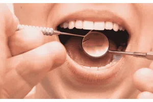 Badanie jamy ustnej wykonywane przez stomatologa z użyciem lusterka dentystycznego i zgłębnika, obraz przedstawiający diagnostykę aft w jamie ustnej, zmian błony śluzowej oraz ocenę stanu zdrowia zębów i dziąseł.