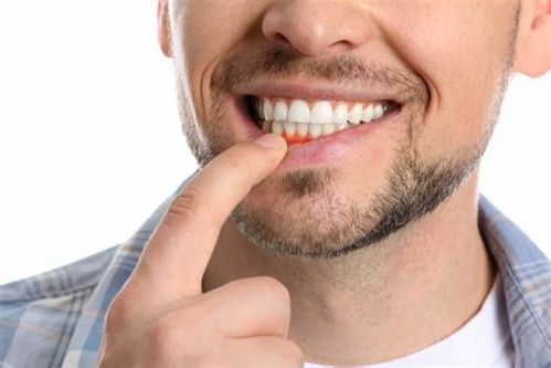 Paradontoza : jakie są objawy i metody leczenia?