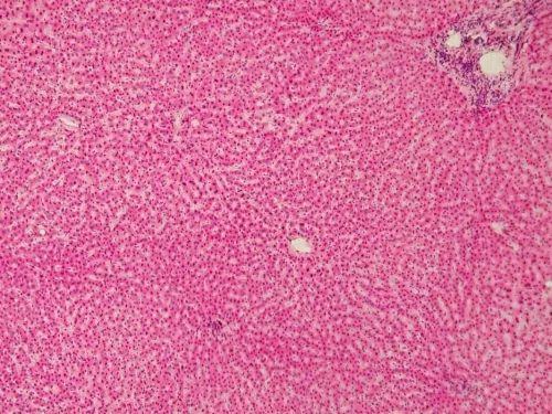 Hepatocyty : czym są? Jaka jest ich rola w wątrobie?