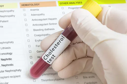 Lipidogram : normy i opis badania