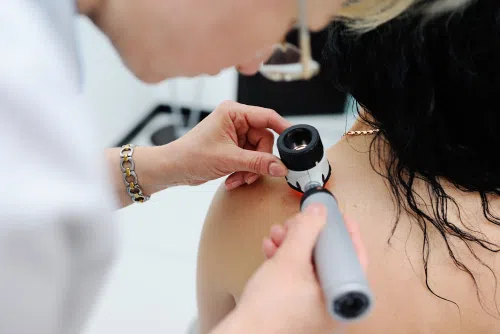 Dermatoskopia: co to za badanie? Wskazania, przebieg i interpretacja wyników