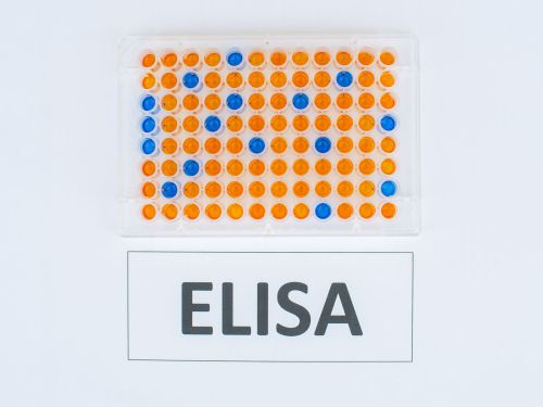 Test ELISA : co wykrywa i na czym polega to badanie?