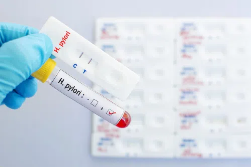 Helicobacter pylori test : rodzaje i skuteczność testów