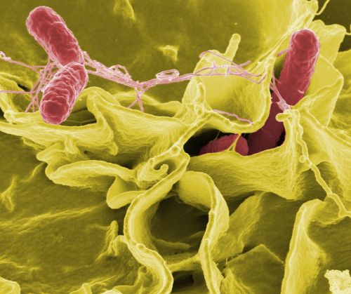 Salmonella : co to za bakteria i czy jest zaraźliwa? Profilaktyka zarażenia