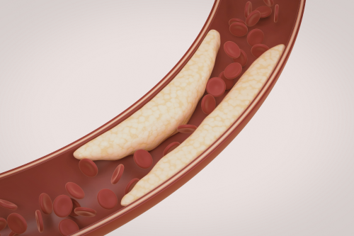 Dobry i zły cholesterol: jakie są różnice?