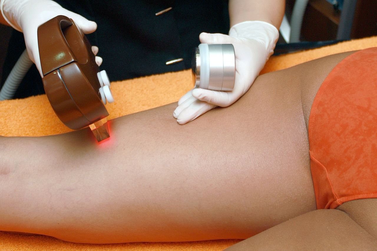 Depilacja Laserowa: Mity i Fakty. Czy To Naprawdę Boli i Czy Jest Bezpieczna? title