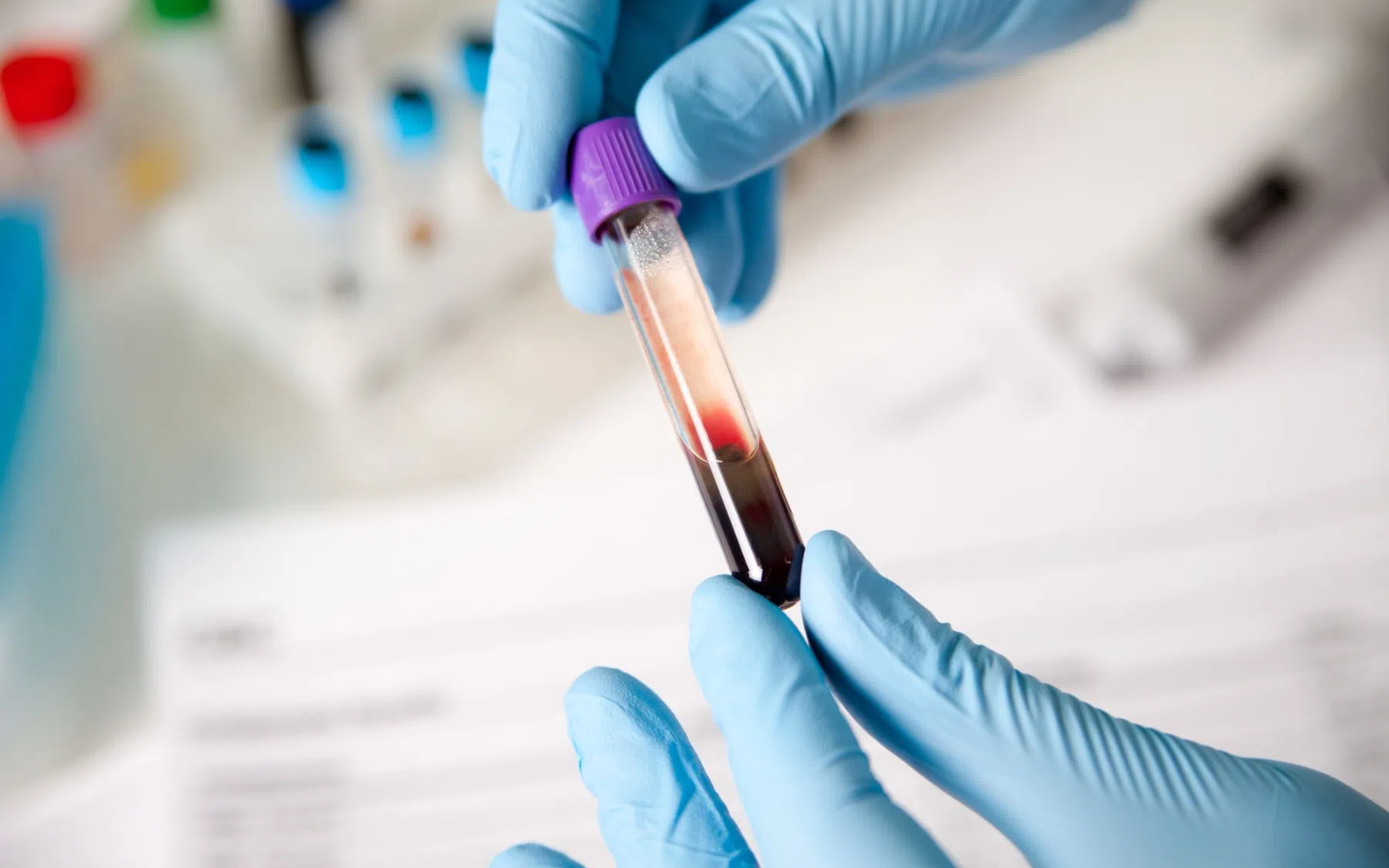 Probówka z pobraną próbką krwi trzymana w dłoniach w rękawiczkach laboratoryjnych, obraz przedstawiający badania diagnostyczne krwi wykorzystywane w rozpoznawaniu hemofilii oraz ocenie zaburzeń krzepnięcia krwi.